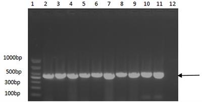 Epidemiological Analysis From 2018 to 2020 in China and Prevention Strategy of Porcine Circovirus Type 2